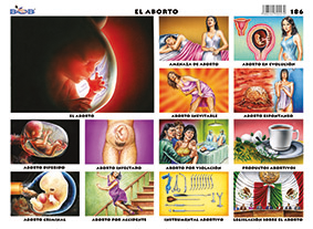 M186 Aborto (25 pzas)