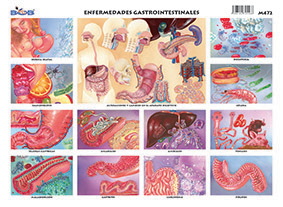 M472 Enfermedades gastrointestinales (25 pzas)